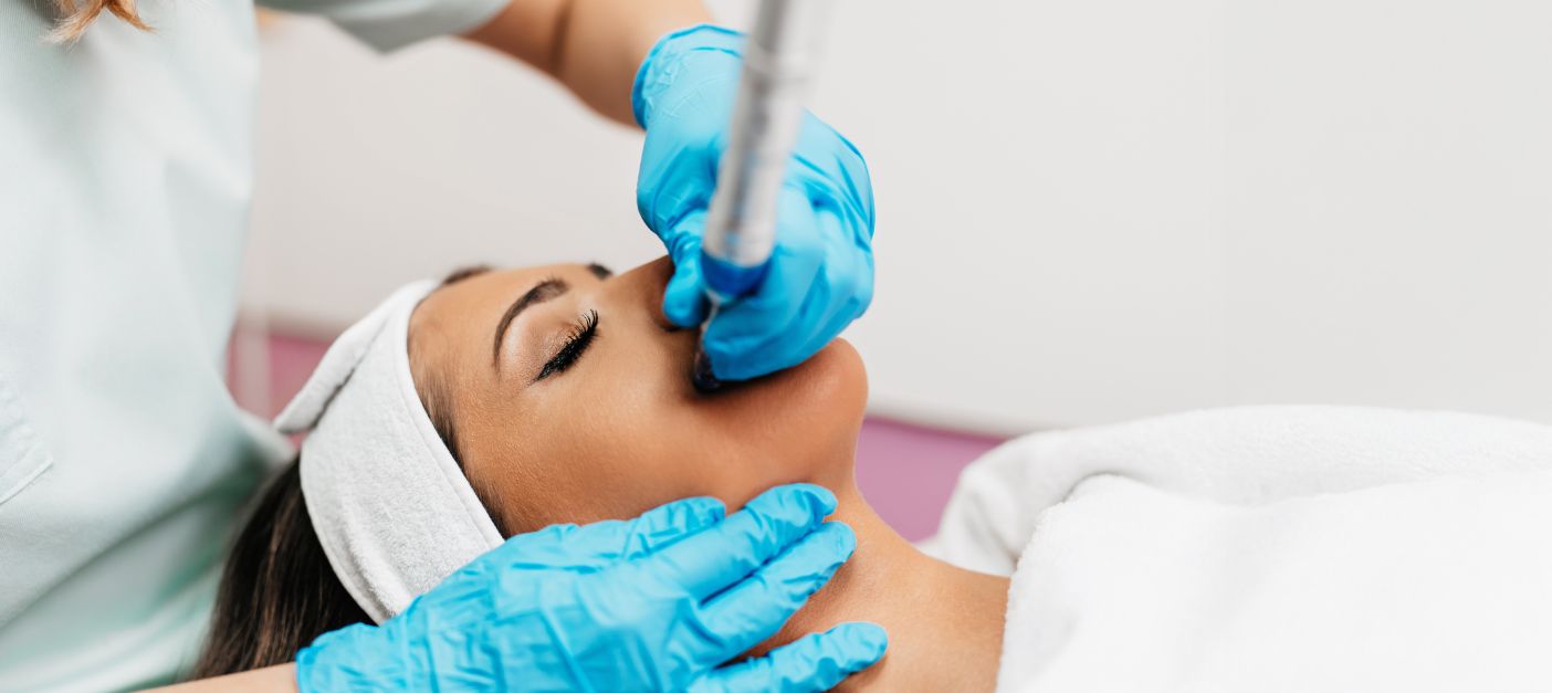 Woman receiving microneedling treatment with PRP