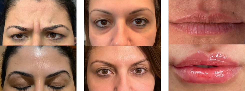 Before and after pictures of aesthetic improvements